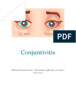 Conjuntivitis 