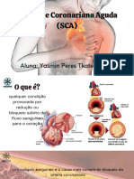 Sindrome Coronariana Aguda (SCA)