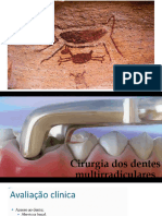 exodontia de dentes multirradiculares