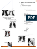 1 Análise Sistemática DO RX DE Tórax