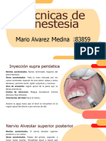 Técnicas de Anestesia