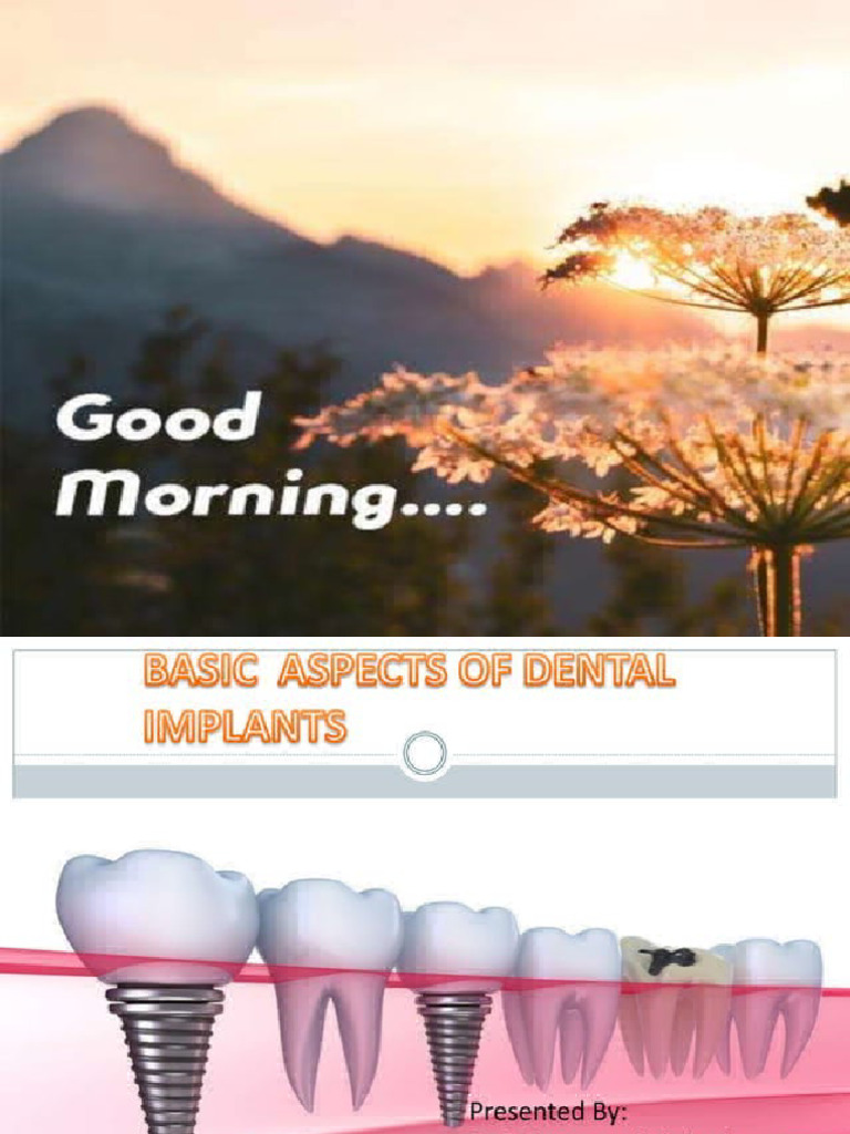 Basic Aspects Of Dental Implants Pdf