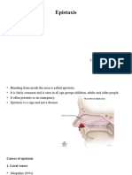 Epistaxis PowerPoint