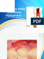 Penyakit Jaringan Periapikal