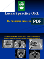 Lucrari Practice ORL II Patologie Rino-Sinusala