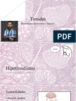 Patologia Tiroidea