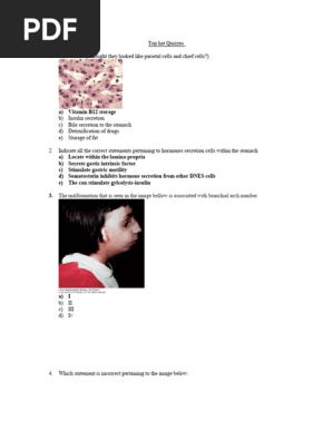Top hat Quizzes