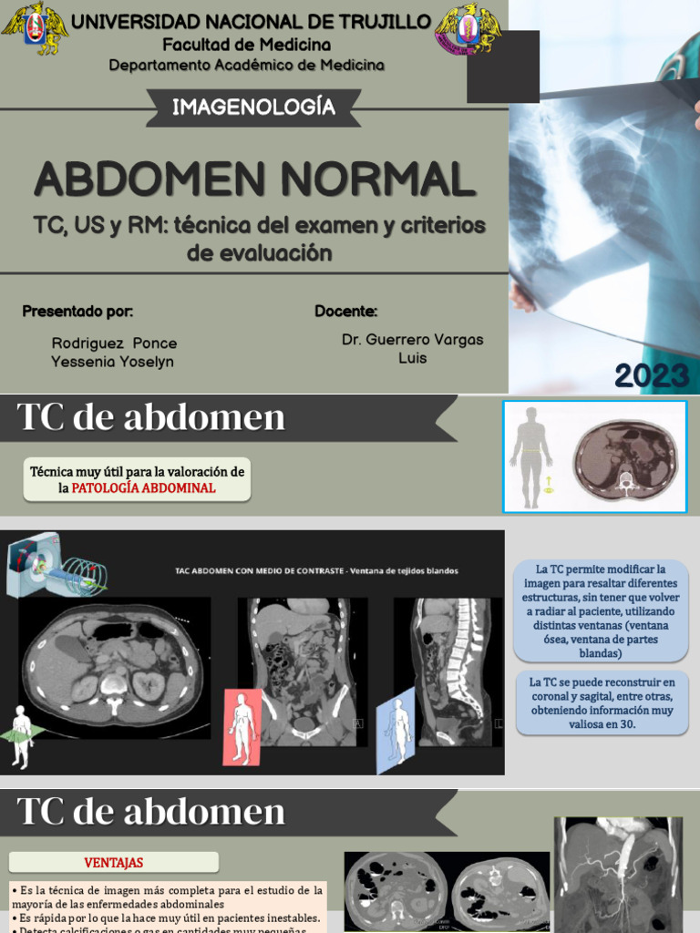 Abdomen Normal-Tc, Us, RM - Rodriguez Ponce Yessenia | PDF