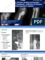 Diverticulos, Pólipos, Úlceras, Patologías Inflamatorias y Tumorales - Esófago, Estómago, Intestino Delgado y Grueso