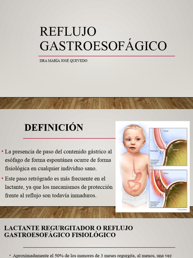 Reflujo Gastroesofágico en Lactantes | PDF | La enfermedad por reflujo ...