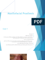 Maxillofacial Prosthesis