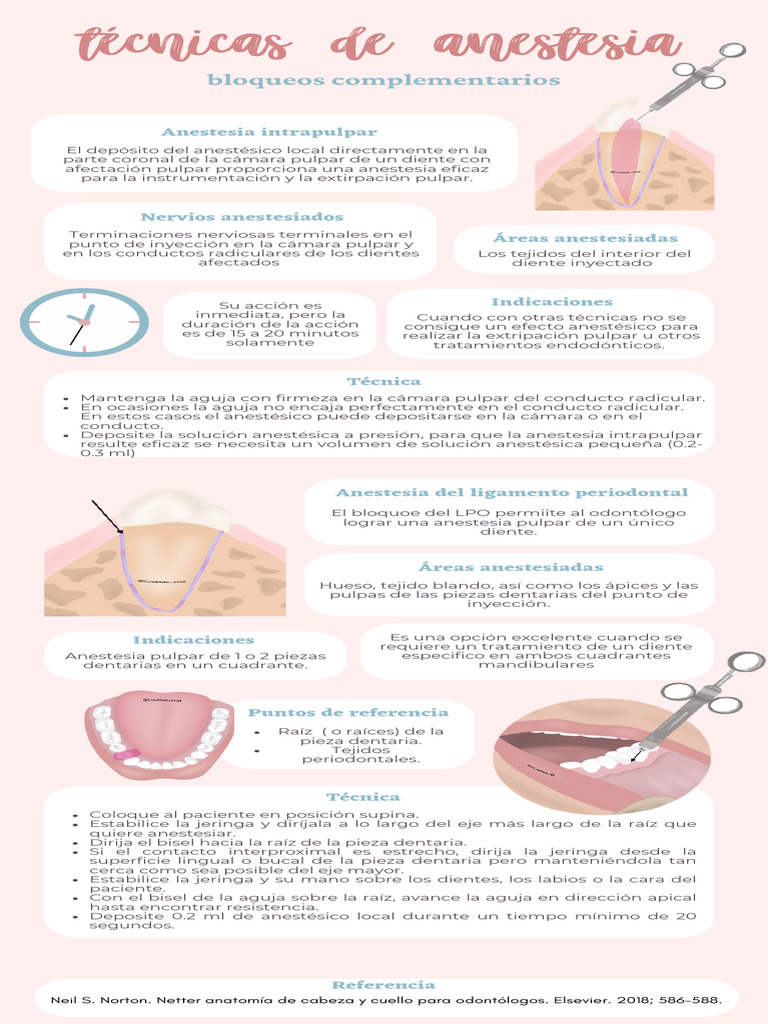 Técnicas de Anestesia Intrapulpar Odontológica | PDF | Odontología ...