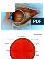 Desprendimiento de retina y hemorragia vítrea