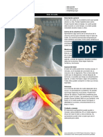 Folleto Dolor de Cuello