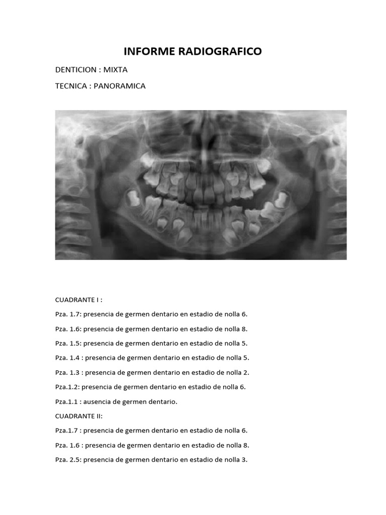 INFORME RADIOGRAFICO - Andrea | PDF
