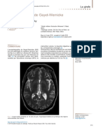 Encéphalopathie de Gayet-Wernicke