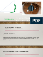 Glaucoma de Angulo Cerrado
