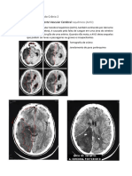 Estudos Radiológico Do Crânio 2