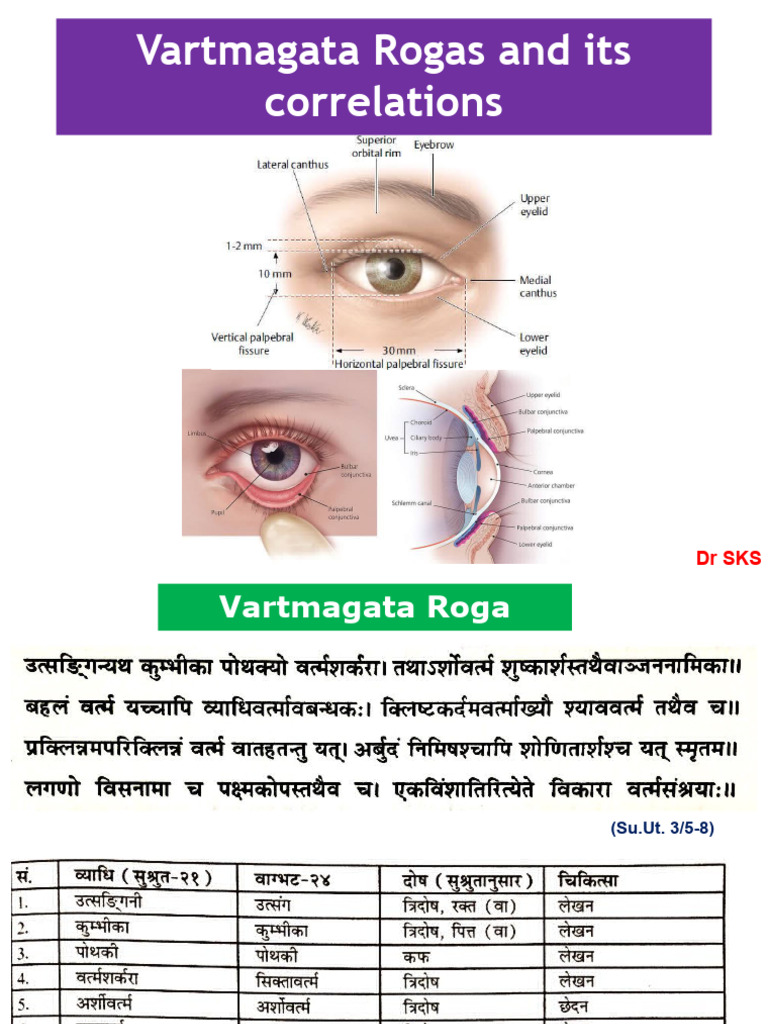 Vartmagata Netra Roga | Download Free PDF | Medicine | Human Eye