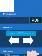 Bradicardias