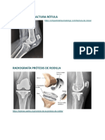 Anatomía Miembro Inferior 2