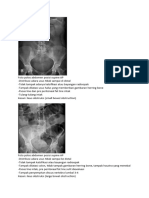 Latihan Abdomen Radiologi