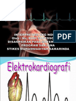 ECG Normal Stikes