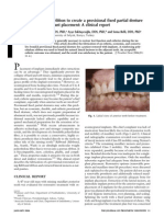 Use of Polyethylene Ribbon To Create A Provisional Fixed Partial Denture