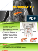 Acute Pancreatitis