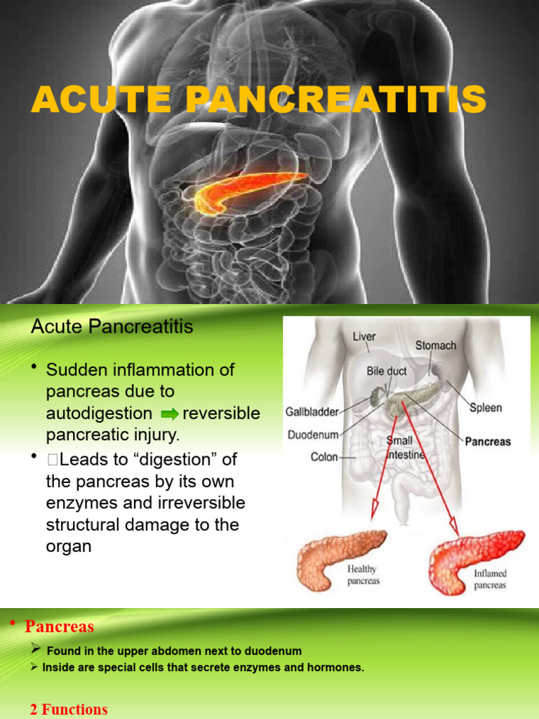 Acute Pancreatitis | PDF