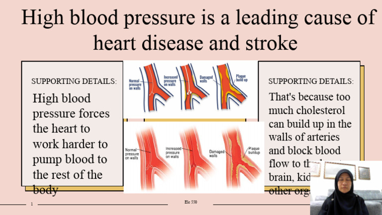 High Blood Pressure: Heart Disease Risk | PDF