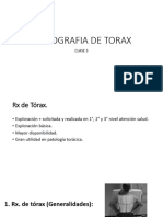 Clase 3 RX de Torax