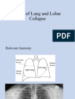 Signs of Lung and Lobar Collapse