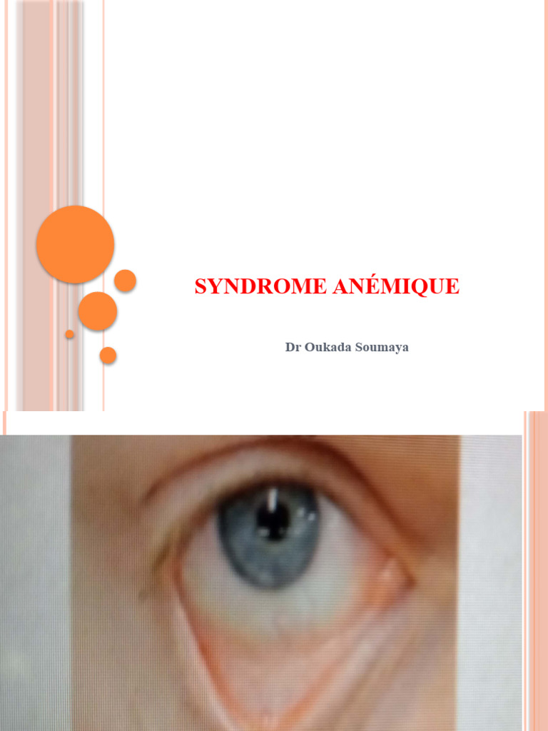 Comprendre le syndrome anémique | PDF