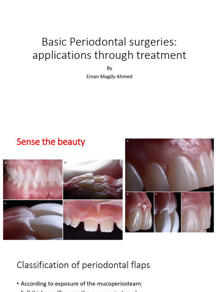 Basic Periodontal Surgeries II Applications V2 PDF Periodontology