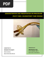 Ryles - Jejunostomy Tube Feeding