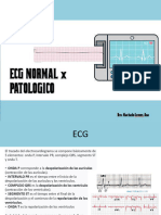 Repaso ECG Ok