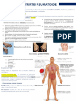 Artritis Reumatoide