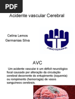 Acidente Vascular Cerebral