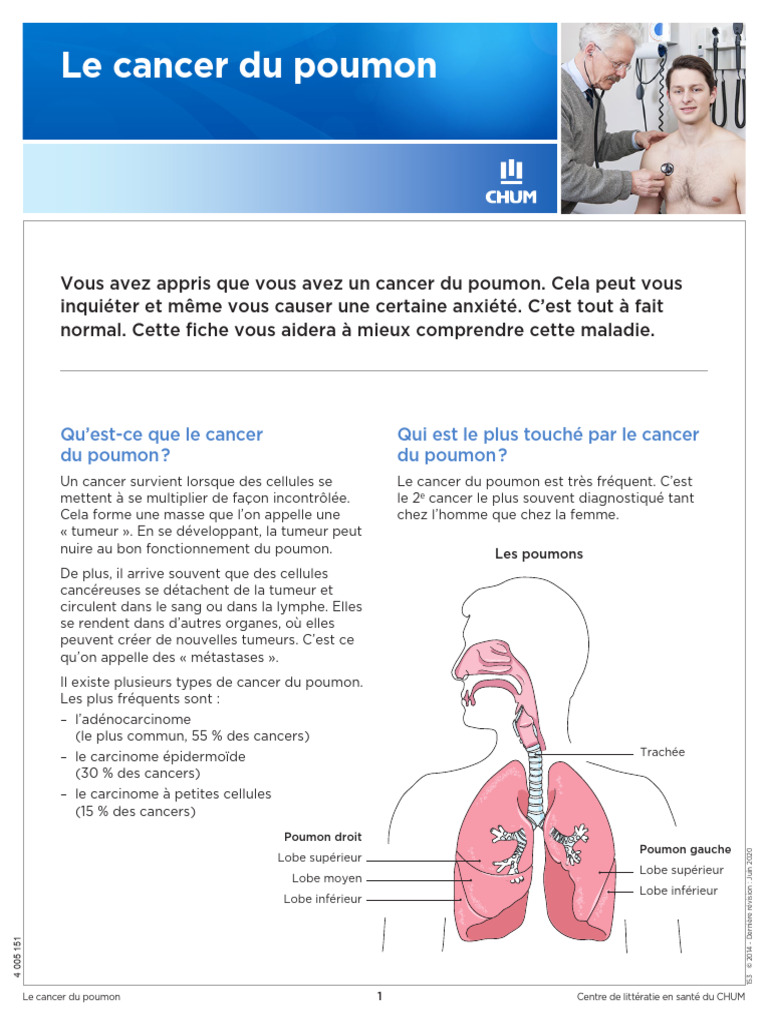 Comprendre le cancer du poumon PDF Développement personnel Bienêtre — free download