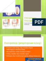 Osteoporosis