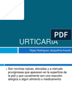 Urticaria