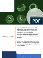 COLELITIASIS