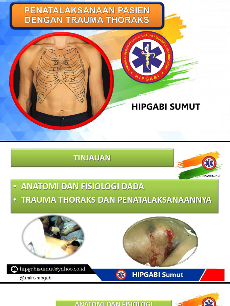 Trauma Thoraks | PDF