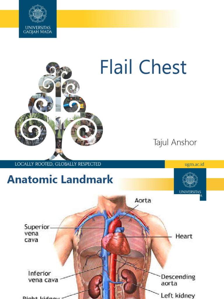 Flail Chest: Definisi dan Tatalaksana | PDF | Ilmu Sosial | Kesehatan ...