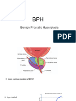 BPH (Benign Prostatic Hyperplasia)