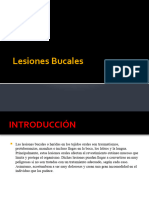 Lesiones Bucales