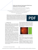 A Novel Approach For Red Lesions Detection Using Superpixel Multi-Feature Classification in Color Fundus Images