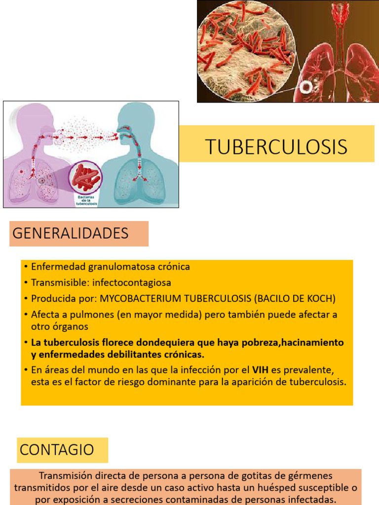 2 Tuberculosis | PDF | Tuberculosis | Infección