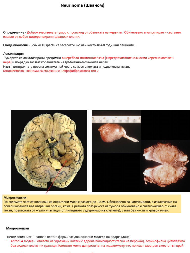 18-neurinoma-pdf